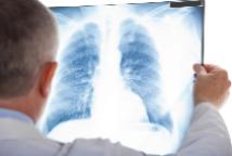 Прохождение флюорографического обследования